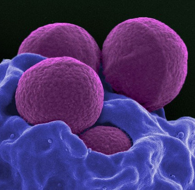 Find a way to kill bacteria in a completely new body