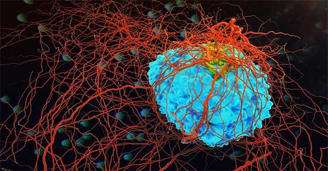 Find a way to prevent metastatic cancer