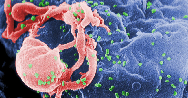 Find new antibodies, disable 98% of the HIV / AIDS gene sequence