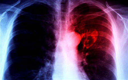 Find out how to heal the heart