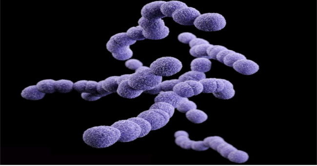 Find out the bacteria that causes death in humans