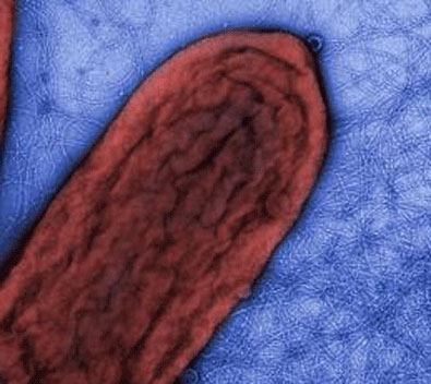 Find out the biological method to remove soluble uranium