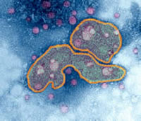 Find out why H5N1 causes high mortality in humans