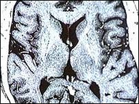 Find the brain area 'Always think for others'