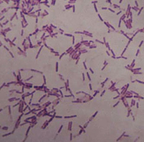 Find the key of immortality from bacteria living 3.5 million years ago
