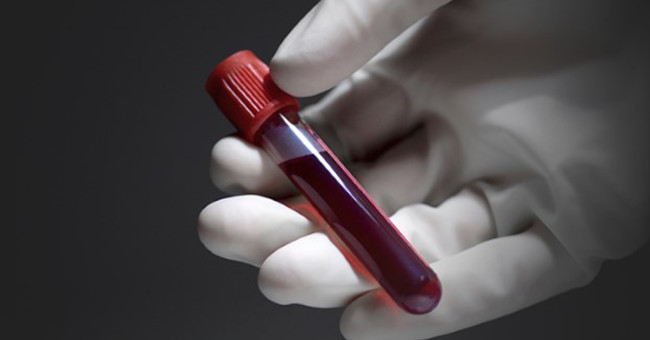 Find the safest cancer test method ever