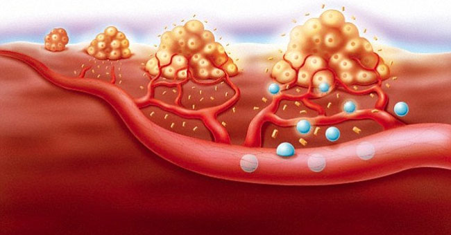 Find the secret why cancer cells are resistant to drugs