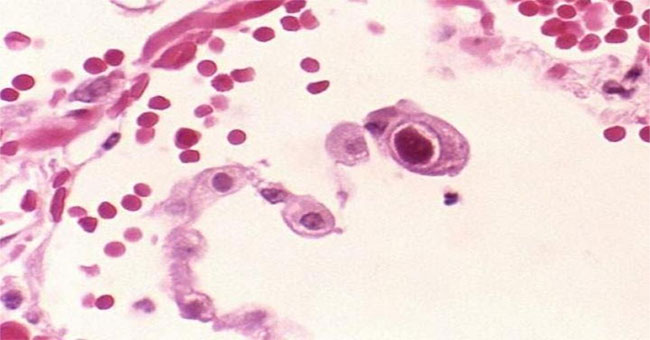 Finding a virus can help strengthen the immune system for the elderly