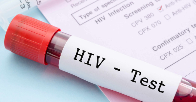 Finding new HIV testing methods gives the fastest results