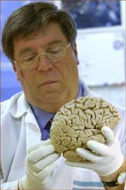 Finding the key gene in the evolution of the human brain