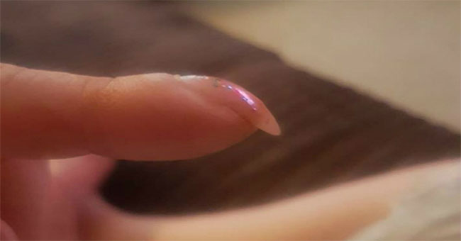 Fingernails overlap warn lung cancer