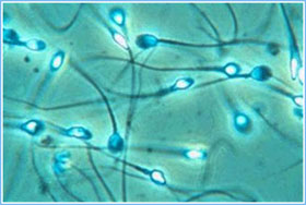 First created artificial sperm