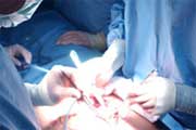 First hand transplant in Medicine history