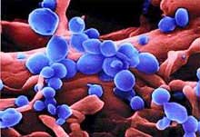 First published photo of avian influenza virus