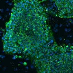 First time creating pluripotent stem cells from horses