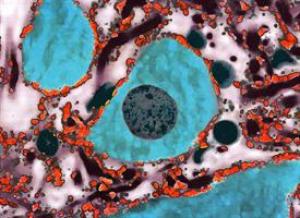 Food colors can reduce spinal cord damage