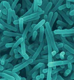 Food poisoning and prevention