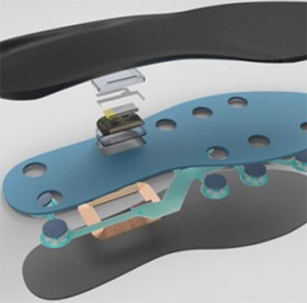 FootLogger - shoe soles