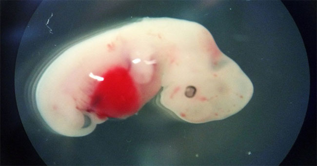 For the first time, an embryo has been successfully created, half a half pig