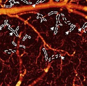 For the first time humans see the impact of drugs on the brain