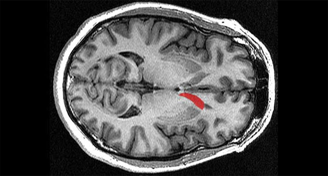 For the first time, scientists found the brain area that causes depression