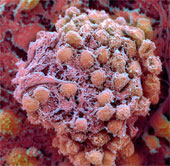 For the first time successfully created stem cells from human skin
