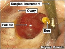 For the first time, the image of ovulation is recorded
