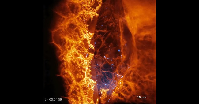 For the first time, we see an image of a cell moving in a living organism