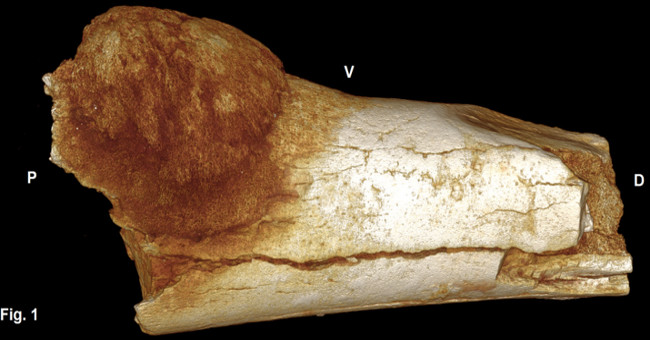 Fossil findings suggest that cancer has been around since prehistoric times