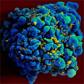 Found a vaccine for HIV?