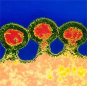 Found the 'pure' of the HIV virus
