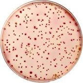 France discovered strange bacteria causing death in babies