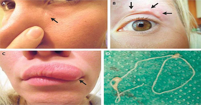 Frightened to know the horrifying truth behind a small, harmless little lump on his face