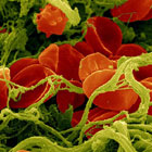 Frozen blood is more elastic than rubber
