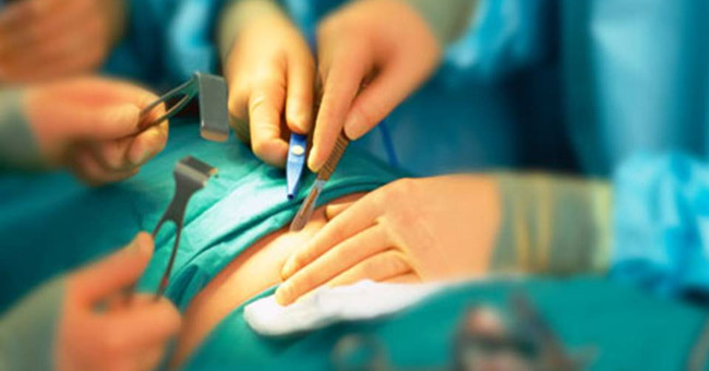 Gastric ligation surgery helps treat type 2 diabetes
