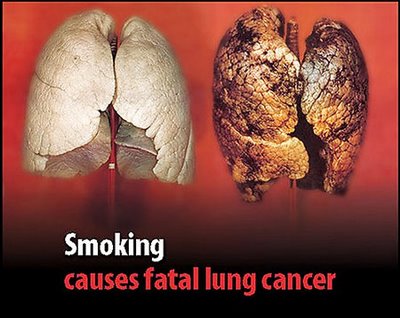 Genes protect the body from lung cancer