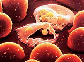 Genetic map: a new tool for malaria research
