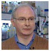 Genetic research shows the relationship between dementia and deformities
