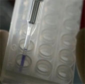 Genetic testing supports prostate cancer treatment
