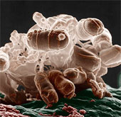 Genetically modified bacteria can prevent obesity