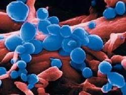 Genetically modified poultry does not transmit the H5N1 virus