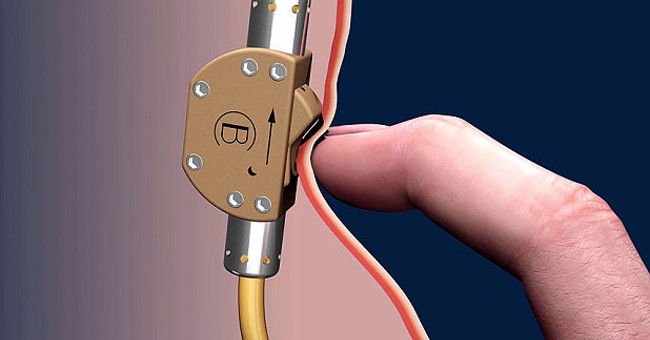 German carpenter invented the sperm lock valve