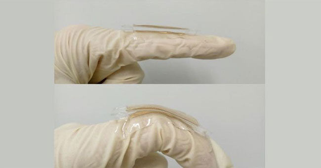 Gold leaf helps to charge the phone by folding the finger