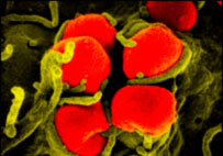 Gonorrhea increases the risk of cancer