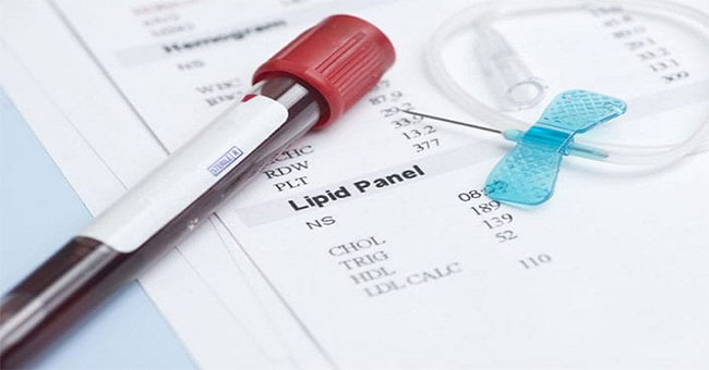Good 'cholesterol' can adversely affect some people
