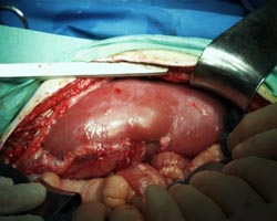 Grafting pig organs for ... people