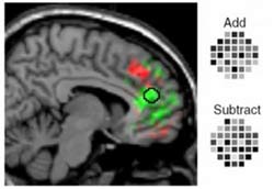 Guess intent through magnetic resonance imaging technique