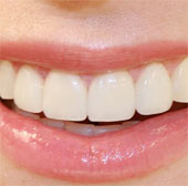 Guess the personality and guess the disease through teeth