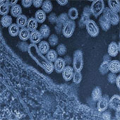 H7N9 influenza virus is more dangerous
