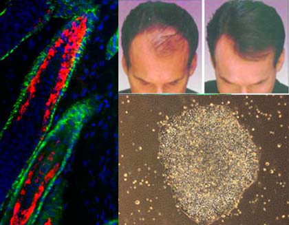 Hair-forming stem cells have been tested in rat skin